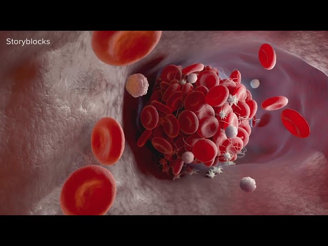 VERIFY: What you need to know about blood clots